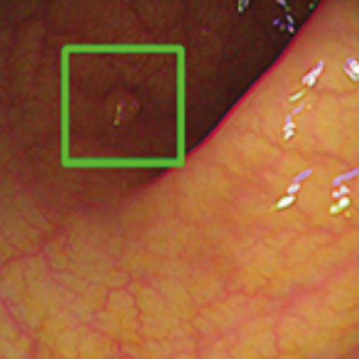 KIPolypQuadrat dffdg