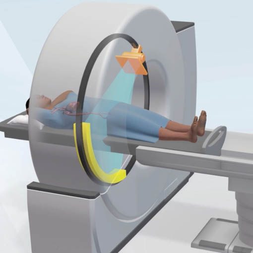 CT: 256-Zeilen CT - low dose screening