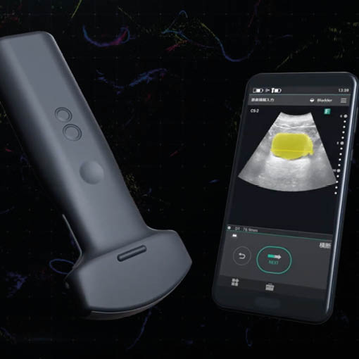Sonographie: strahlenfreie Diagnostik mit Ultraschall